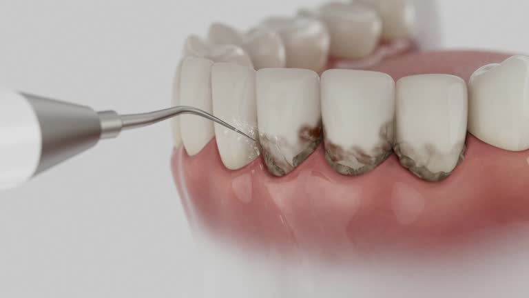 Trusted Teeth Cleaning And Checkup service in Central Heights-Midland City, AZ - Dentist Open Now